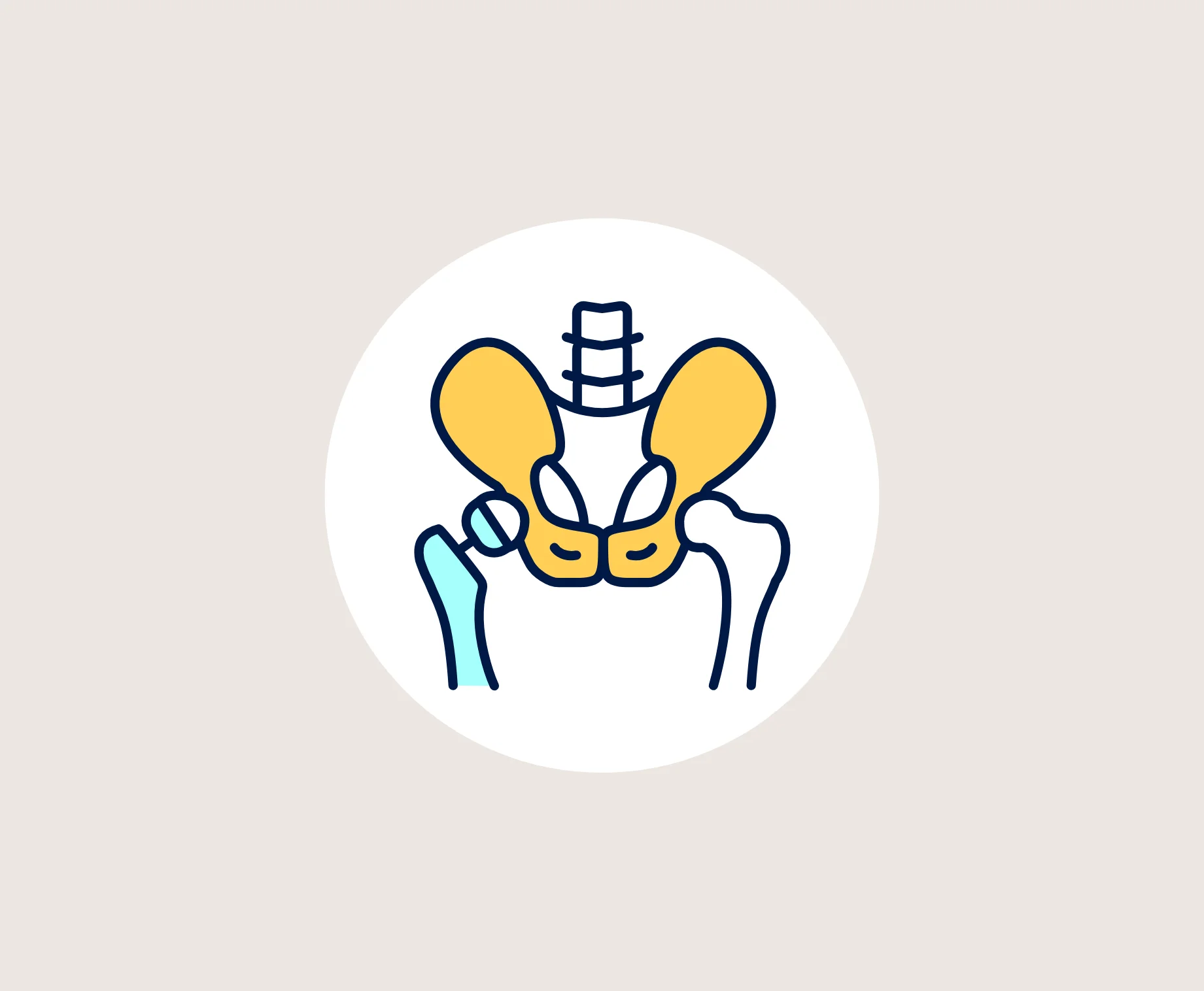   Arthroplasty and Joint Replacement Surgeries in Hyderabad